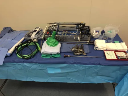 Laparoscopic Appendectomy — setup photo