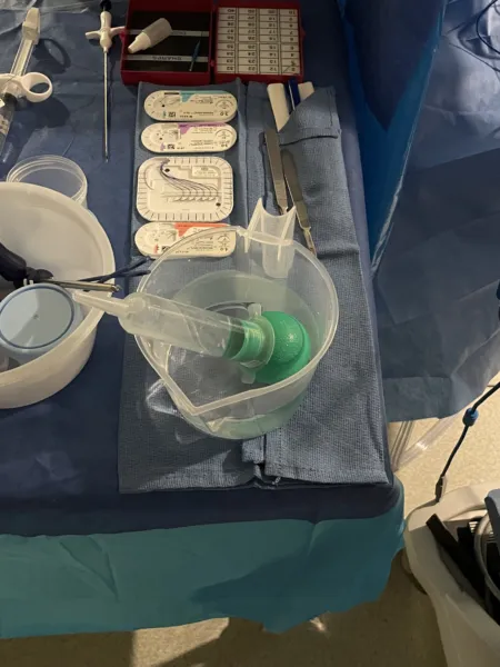 Laparoscopic Gastric Bypass Roux-EN-Y, setup photo