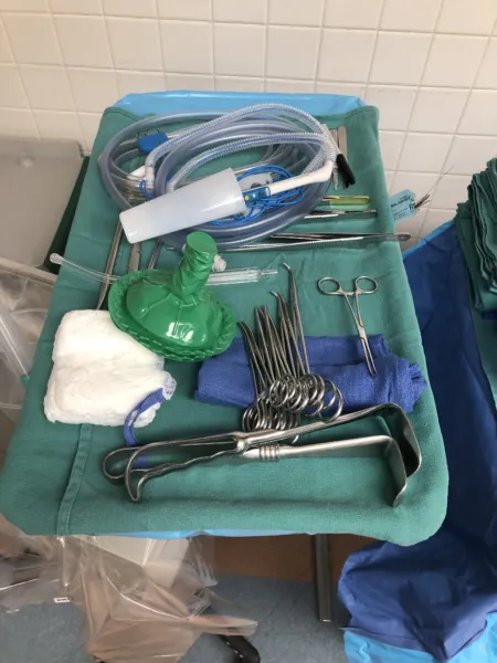 Splenectomy — setup photo