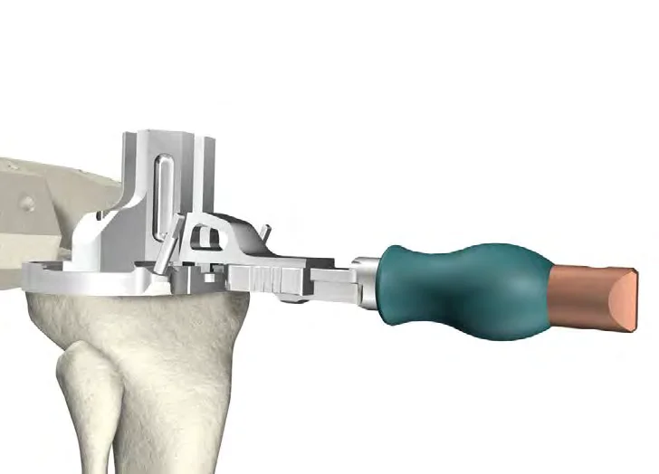 Triathlon Keel Punch Guide