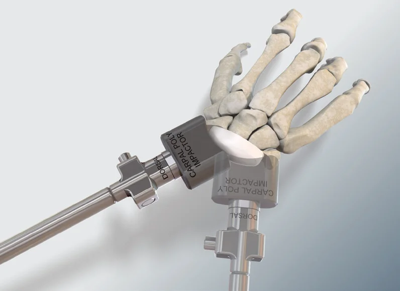Carpal Poly Impactor