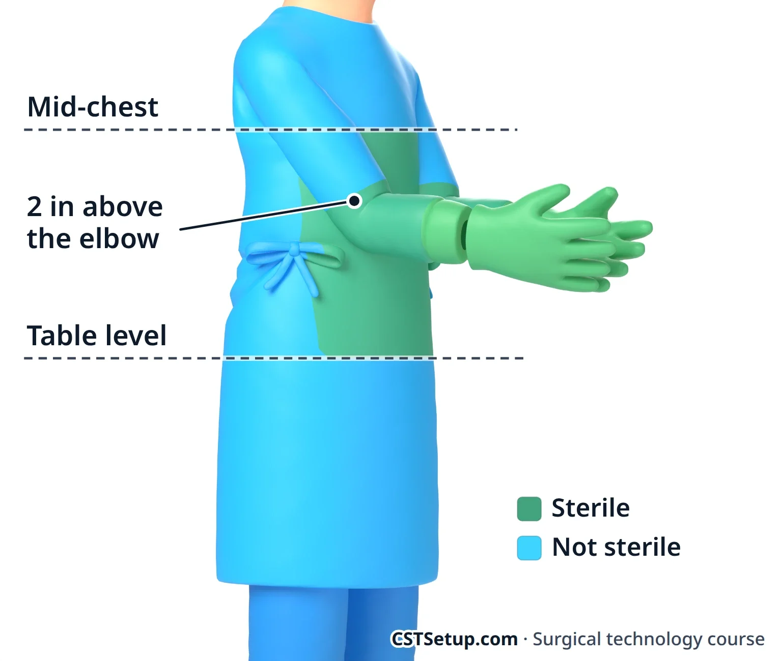 A gown is sterile in front from mid-chest to the level of the sterile field, and on the sleeves from the cuff to 2 inches above the elbow.